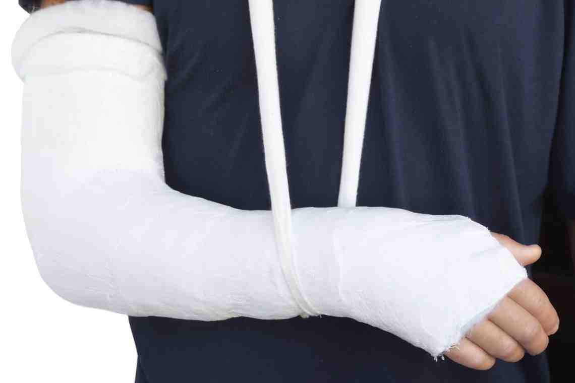 Перелом руки: симптомы, диагностика и особенности лечения